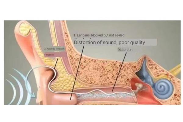 What is the problem with hearing aids? What should I do?